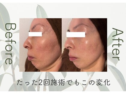 美成(vise)の写真