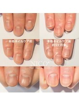 ニコプラス(NICO+)/ジェルネイルができない方向け