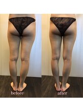 ラウレア 西条店(LAULEA)/ハイパーナイフafter/before