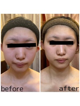 ドクタージェーナ(Dr.Jena)/お客様before/after