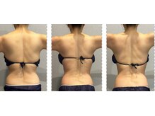 ラヴィエール(Laviere)/【レディース痩身】120分