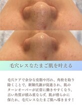 ビューティースタジオ韓美 渋谷店 毛穴ケア 