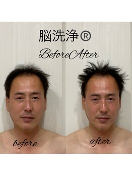 パラフューズ 札幌店 ブランジュ(PARAFUSE.)の写真/男性人気☆脳洗浄ヘッドスパが導く極上の癒しと睡眠◎集中力・仕事の効率UP!毛穴洗浄で肌管理も叶う◎