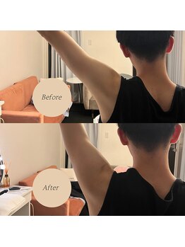 ロアー 赤坂店(RAWR)/肩こりなど悩みの箇所を根本改善