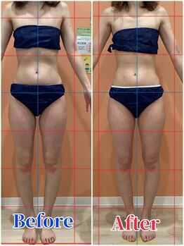 ハンズ鍼灸接骨院小牧院 美容整体ハンズ(美容整体hands)/エステ 痩身