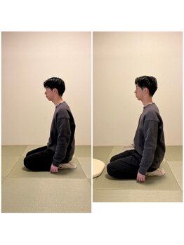 ツリー鍼灸整骨院 吹田店(TREE鍼灸整骨院)/ストレートネックの改善可能！