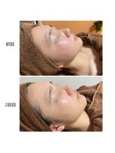 トータルビューティーサロン ヴィヴィエ(ViVier)/ララピール