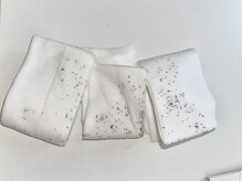 ラッシュ(RUSH)/青髭の男性の初回施術後…