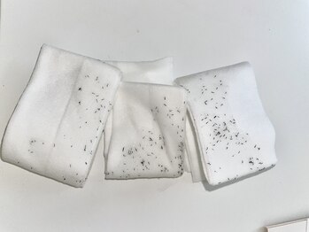 ラッシュ(RUSH)/青髭の男性の初回施術後…