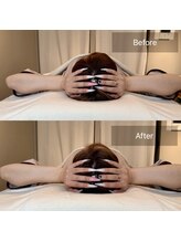 小顔矯正&美容整体サロン　Still U 渋谷/ヘッドスパ＋小顔矯正