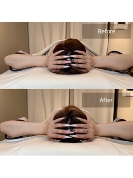 小顔矯正&美容整体サロン Still U 渋谷/ヘッドスパ+小顔矯正