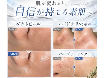ソアン(Soin)の写真