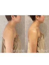 ラズ(Luz)/【小顔100分コース】