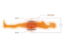 インディラグゼ 麻布十番/深部・浅部・局部に幅広く施術可