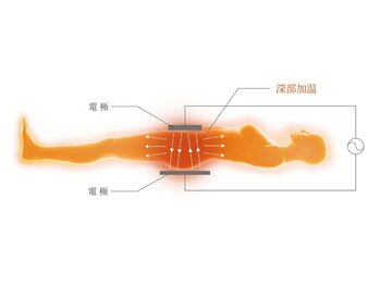 インディラグゼ 麻布十番/深部・浅部・局部に幅広く施術可