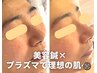 桜/【プラズマ+鍼があなたの肌に革命を起こす】サイエンス美容★15500→11000