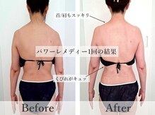 アモントベール