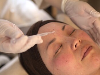 皇漢堂鍼灸療院/最新美容鍼【ダーマ鍼】の流れ-4