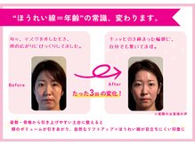 理想の小顔 福島店の雰囲気（正しい姿勢が小顔を作り顔のむくみや法令線が減り、理想の小顔に）