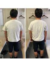 スイッチ 浜松町大門(SWITCH)/猫背の改善