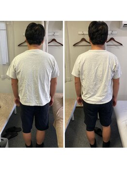 スイッチ 浜松町大門(SWITCH)/猫背の改善