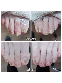 爪切り屋 足楽/爪切りで表情が変わります