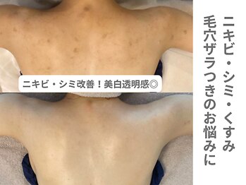 アンシャンテ 神戸元町店(Enchante)/ブライダルエステ神戸元町三ノ宮