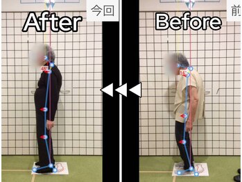 美波整体院 矢巾院/姿勢before→after