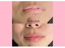 ハーシークレット(Her secret)/ララピンク・メラニンケア