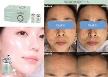 リスキン(Reskin)