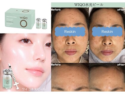 リスキン(Reskin)の写真