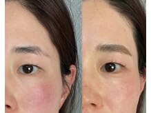 ビースタジオ アクト(B-studio A.c.t.)/ハリウッドブロウリフト