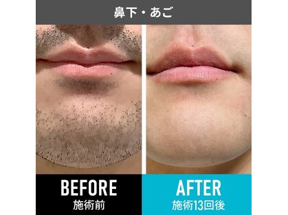 RBL 上野店の写真