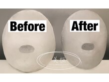 美極 トータルビューティー(美極 TOTAL BEAUTY)/恵比寿/小顔コルギ/エステ/