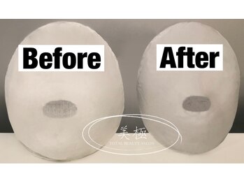 美極 トータルビューティー(美極 TOTAL BEAUTY)/恵比寿/小顔コルギ/エステ/