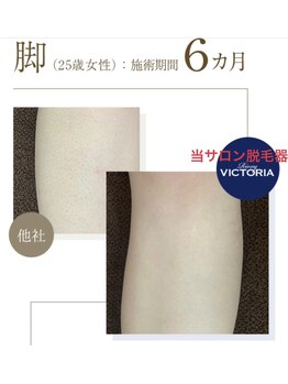 エムズスタイル ネイルバー(M's Style NAIL BAR)/脚脱毛