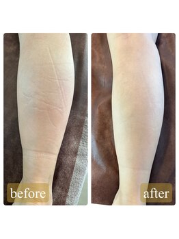 プライベートサロン ヴィヴィアン(Vivian)/脅威の痩身効果☆キャビマックス