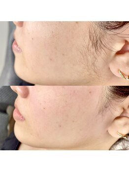 スリーノッツ(THREE KNOTS)/【フェイスwax】