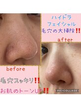 ジュネル ローズ(JEWNEL ROSE)/2回目の効果の写真です！