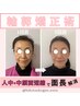 【小顔矯正写真掲載NGの方】　¥29800