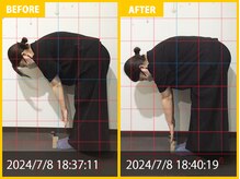 整体院 元 宇城松橋店/腰痛と体の硬さで来院されました