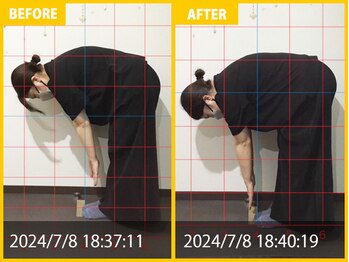 整体院 元 宇城松橋店/腰痛と体の硬さで来院されました