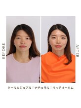 シュアリー(Surely)/トータルコースお客様事例