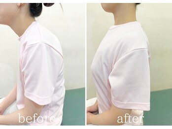 カイロライン 三鷹整体院/肩こり×猫背矯正 / BeforeAfter