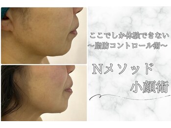 ナニワ ビューティー(naniwa beauty)