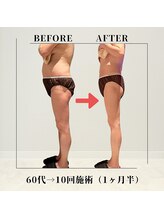 フェムビー 千葉駅前店(FEMBE)/痩身）60代の方の変化