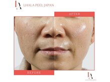 ティアラ(TIARA)/ララピール