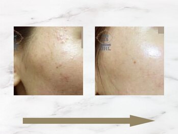 ハリロイヤル トーキョー武蔵小山/美白もツヤも当たり前。