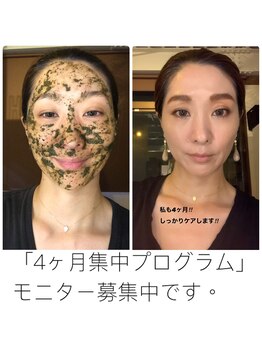 エステティックシトラス(esthetic CITRUS)/TIPハーブモニター