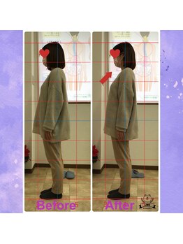 カイロプラクティック コダマ(KODAMA)/産後